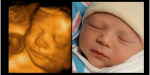 3d-ultrasound-300x150