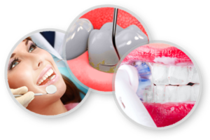 dental-cleaning