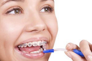 gum-disease-and-orthodontics